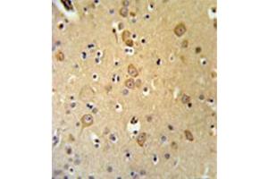 Immunohistochemistry (Paraffin-embedded Sections) (IHC (p)) image for anti-Leucine Rich Repeat Transmembrane Neuronal 1 (LRRTM1) (AA 95-125), (Middle Region) antibody (ABIN953238)