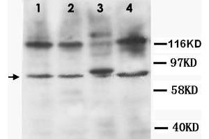 Western Blot analysis of TNFRSF1B expression from cell extracts with TNFRSF1B polyclonal antibody . (TNFRSF1B 抗体  (N-Term))
