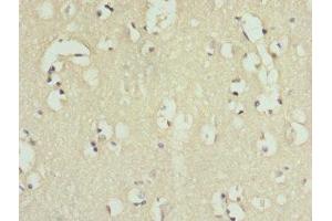 Immunohistochemistry of paraffin-embedded human brain tissue using ABIN7156942 at dilution of 1:100 (IL9 Receptor 抗体  (AA 272-521))