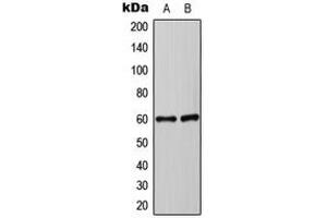 Western blot analysis of Synaptotagmin expression in HEK293T (A), Jurakt (B) whole cell lysates. (Synaptotagmin 抗体  (Center))