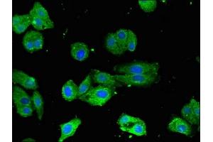 Immunofluorescent analysis of HepG2 cells using ABIN7148675 at dilution of 1:100 and Alexa Fluor 488-congugated AffiniPure Goat Anti-Rabbit IgG(H+L) (CRTC1 抗体  (AA 1-248))