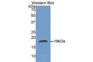 Western Blotting (WB) image for anti-Charcot-Leyden Crystal Protein (CLC) (AA 2-142) antibody (ABIN1175668) (Galectin 10 抗体  (AA 2-142))