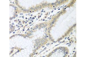 Immunohistochemistry of paraffin-embedded Human stomach using RPN2 Polyclonal Antibody at dilution of 1:100 (40x lens). (Ribophorin II 抗体)