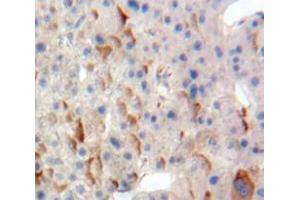 Used in DAB staining on fromalin fixed paraffin-embedded Liver tissue (TPBG 抗体  (AA 32-351))