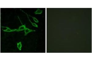 Immunofluorescence analysis of LOVO cells, using HRH1 Antibody. (HRH1 抗体  (AA 141-190))