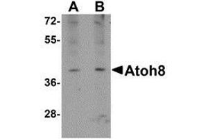 Western blot analysis of ATOH8 in A-20 cell lysate with this product atOH8 antibody at (A) 1 and (B) 2 μg/ml. (ATOH8 抗体  (C-Term))