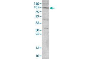 Western blot was performed on nuclear extracts from HeLa cells (HeLa NE, 40 ug) with PADI4 polyclonal antibody , diluted 1 : 1,000 in TBS-Tween containing 5% skimmed milk. (PAD4 抗体)