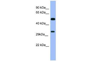 WB Suggested Anti-MAGEB1 Antibody Titration: 0. (MAGEB1 抗体  (Middle Region))