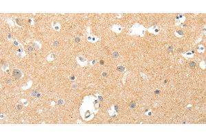 Immunohistochemistry of paraffin-embedded Human brain tissue using TNXB Polyclonal Antibody at dilution 1:40 (TNXB 抗体)