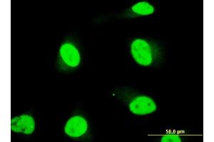 Immunofluorescence of monoclonal antibody to SOX18 on HeLa cell. (SOX18 抗体  (AA 63-150))