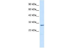 WB Suggested Anti-CLIC2 Antibody Titration:  1. (CLIC2 抗体  (Middle Region))
