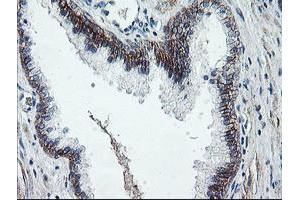 Image no. 1 for anti-Dystrobrevin, beta (DTNB) antibody (ABIN1497913) (Dystrobrevin beta 抗体)
