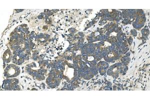 IHC analysis of CDC123 using anti-CDC123 antibody (ABIN7599284).