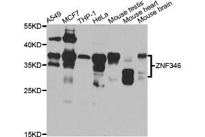 Western blot analysis of extracts of various cell lines, using ZNF346 antibody (ABIN5975303) at 1/1000 dilution. (ZNF346 抗体)