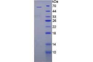 SDS-PAGE analysis of Human PRG2 Protein. (Major Basic Protein 蛋白)