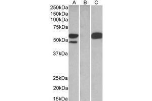 HEK293 lysate (10 µg protein in RIPA buffer) overexpressing Human TRIM21 with C-terminal MYC tag probed with AP22453PU-N TRIM21 antibody (1 µg/ml) in Lane A and probed with anti-MYC Tag (1/1000) in Lane C. (TRIM21 抗体  (C-Term))