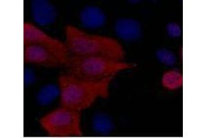 Immunofluorescence (IF) analysis of 293 cells transfected with a His-tag protein,1:1000 dilution (blue DAPI, red anti-His) (His Tag 抗体)