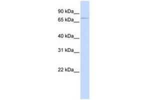 Image no. 1 for anti-ATP-Binding Cassette, Sub-Family B (MDR/TAP), Member 8 (ABCB8) (AA 540-589) antibody (ABIN6740837) (ABCB8 抗体  (AA 540-589))