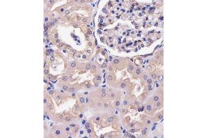(ABIN6243119 and ABIN6578706) staining COPS7B in human kidney tissue sections by Immunohistochemistry (IHC-P - paraformaldehyde-fixed, paraffin-embedded sections). (COPS7B 抗体  (AA 61-95))