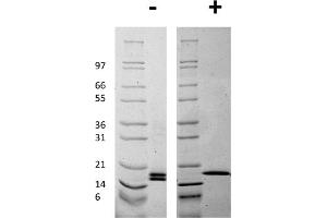 SDS-PAGE of Human Mouse Fibroblast Growth Factor basic Recombinant Protein SDS-PAGE of Mouse Fibroblast Growth Factor basic Recombinant Protein. (FGF2 蛋白)