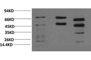 Western Blotting (WB) image for anti-Phosphoserine (Phosphospecific) antibody (ABIN5962159) (Phosphoserine 抗体  (Phosphospecific))