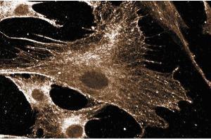 Immunofluorescent staining of human fibroblast cells. (RAC1 抗体)