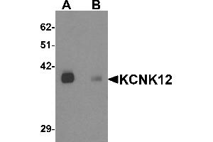 Western blot analysis of KCNK12 in rat brain tissue lysate with KCNK12 antibody at 0. (KCNK12 抗体  (C-Term))