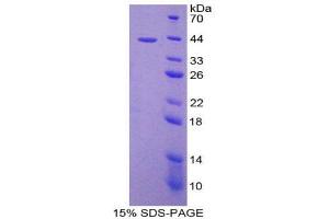 SDS-PAGE (SDS) image for Chemokine (C-C Motif) Ligand 8 (CCL8) (AA 1-99) protein (His tag,GST tag) (ABIN1980645) (CCL8 Protein (AA 1-99) (His tag,GST tag))