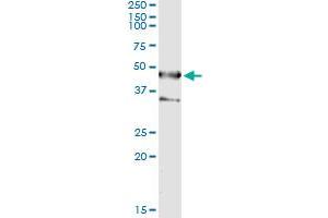 Immunoprecipitation of SEPT1 transfected lysate using anti-SEPT1 monoclonal antibody and Protein A Magnetic Bead , and immunoblotted with SEPT1 MaxPab rabbit polyclonal antibody. (Septin 1 抗体  (AA 1-367))
