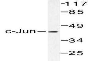 Image no. 2 for anti-Jun Proto-Oncogene (JUN) antibody (ABIN265356) (C-JUN 抗体)