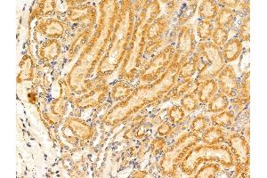 ABIN7094719 and ABIN7098770 at 1/100 staining Rat kidney tissue by IHC-P. (GUCY1A2 抗体  (N-Term))