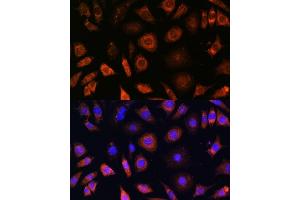 Immunofluorescence (IF) image for anti-Prefoldin Subunit 4 (PFDN4) (AA 1-134) antibody (ABIN7269508)