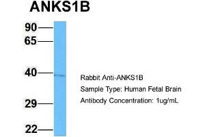 Host: Rabbit Target Name: ANKS1B Sample Type: Human Fetal Brain Antibody Dilution: 1. (ANKS1B 抗体  (C-Term))