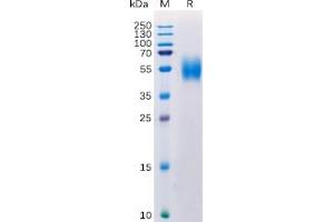 Human MICA Protein, His Tag on SDS-PAGE under reducing condition. (MICA Protein (His tag))