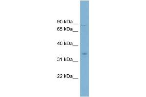 WB Suggested Anti-GPD2 Antibody Titration:  0. (GPD2 抗体  (Middle Region))