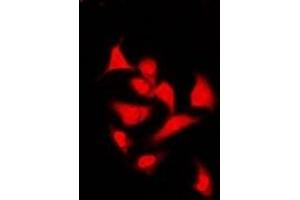 Immunofluorescent analysis of Spot 14 staining in U2OS cells. (THRSP 抗体)