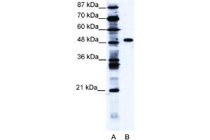 WB Suggested Anti-ZNF541 Antibody Titration: 1. (ZNF541 抗体  (Middle Region))