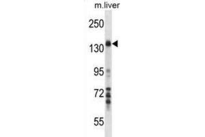 Western Blotting (WB) image for anti-Mitogen-Activated Protein Kinase Kinase Kinase 1 (MAP3K1) antibody (ABIN2998117) (MAP3K1 抗体)