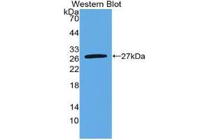Western blot analysis of the recombinant protein. (Nephrin 抗体  (AA 27-234))