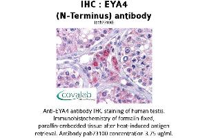 Image no. 2 for anti-Eyes Absent Homolog 4 (EYA4) (N-Term) antibody (ABIN1734196) (EYA4 抗体  (N-Term))