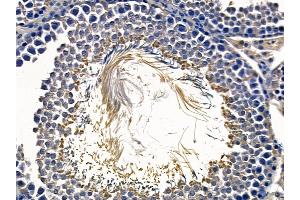 ABIN6258269 and ABIN6273857 at 1/100 staining rat testis tissue by IHC-P. (GPR15 抗体  (C-Term))
