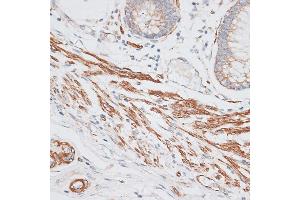 Immunohistochemistry (IHC) image for anti-G Protein-Coupled Receptor Kinase 5 (GRK5) (AA 371-590) antibody (ABIN1680115)