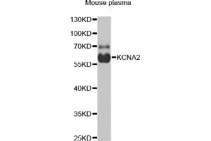 Western blot analysis of extracts of mouse plasma, using KCN antibody (ABIN6129438, ABIN6142695, ABIN6142696 and ABIN6221897) at 1:1000 dilution. (KCNA2 抗体  (AA 1-165))