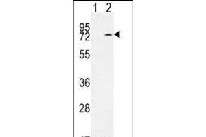 Western blot analysis of KARS (arrow) using rabbit polyclonal KARS Antibody (N-term) (ABIN655049 and ABIN2844677). (KARS 抗体  (N-Term))