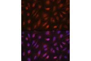 Immunofluorescence analysis of U2OS cells using CETN3 antibody (ABIN7268452) at dilution of 1:100. (CETN3 抗体  (AA 1-167))