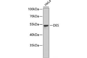 Western blot analysis of extracts of HeLa cells using DES Polyclonal Antibody. (Desmin 抗体)