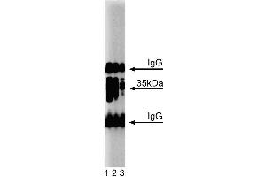 Western blot analysis of Arginase I on a mouse liver lysate. (Liver Arginase 抗体  (AA 53-207))