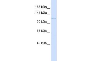 WB Suggested Anti-PTCH2 Antibody Titration:  0. (Patched 2 抗体  (N-Term))