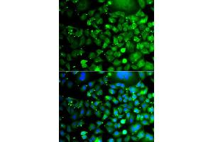 Immunofluorescence analysis of A549 cell using MOCS3 antibody. (MOCS3 抗体)
