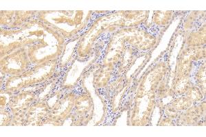 Detection of Tie1 in Human Kidney Tissue using Polyclonal Antibody to Tyrosine Kinase With Immunoglobulin Like And EGF Like Domains Protein 1 (Tie1) (TIE1 抗体  (AA 435-609))